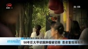 50年巨大甲状腺肿瘤被切除 患者重现细长脖资讯完整版视频在线观看爱奇艺