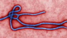 埃博拉症状和艾滋病类似，但患者会体内出血，极度痛苦的死去