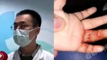 郑州一奶奶用老鼠熬油治疗孩子烫伤，致孩子感染进重症监护室！